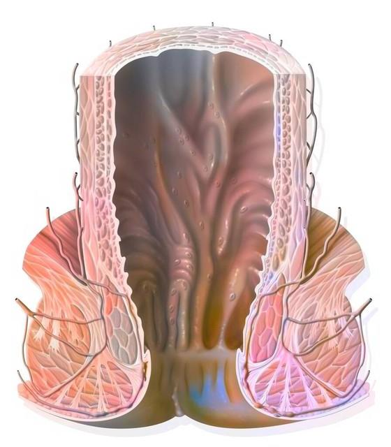 “難以啟齒”的肛門癌 你瞭解嗎？醫生：出現4個癥狀 及時就醫檢查插图2