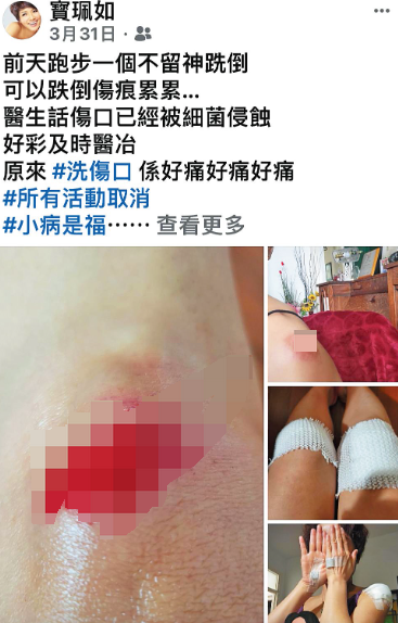 59歲TVB戲骨街頭跑步出意外，摔到遍體鱗傷，緊急打破傷風針插图5