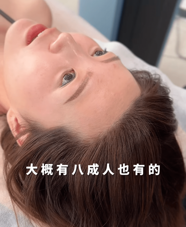 31歲TVB女星患汗管瘤無法治愈，腹部曾有拳頭大腫瘤要借錢做手術插图3